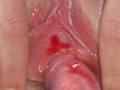 Attention defloration d une vierge reelle